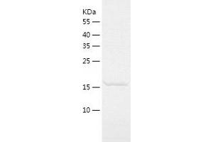 Western Blotting (WB) image for Centrin, EF-Hand Protein, 3 (CETN3) (AA 1-167) protein (His-IF2DI Tag) (ABIN7122239)