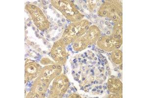 Immunohistochemistry of paraffin-embedded rat kidney using AKR1A1 antibody.