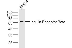 Molt-4 lysates probed with Insulin Receptor Beta Polyclonal Antibody, Unconjugated  at 1:300 dilution and 4˚C overnight incubation. (ISR-beta anticorps  (AA 1001-1100))