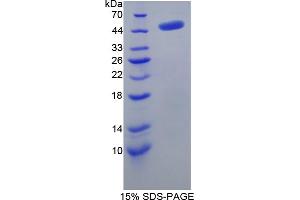 Image no. 1 for Adenosylhomocysteinase (AHCY) (AA 2-432) protein (His tag) (ABIN4990556)