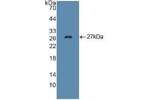 Western blot analysis of recombinant Mouse FBN1. (Fibrillin 1 anticorps  (AA 957-1143))