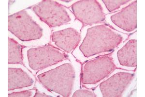 Human Skeletal Muscle: Formalin-Fixed, Paraffin-Embedded (FFPE). (TCEB1 anticorps  (Biotin))