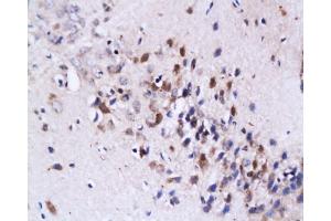 Formalin-fixed and paraffin embedded: rat brain tissue labeled with Anti-FasL Polyclonal Antibody, Unconjugated  at 1:200, followed by conjugation to the secondary antibody and DAB staining
