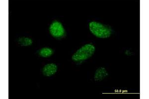 Immunofluorescence of purified MaxPab antibody to C14orf106 on HeLa cell.