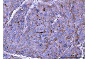 IHC analysis of ch TOG/CKAP5 using anti-ch TOG/CKAP5 antibody (ABIN6719294). (CKAP5 anticorps  (AA 1-221))