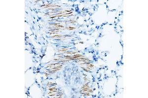 Immunohistochemistry of paraffin-embedded mouse lung using Desminmin Rabbit pAb (ABIN3021114, ABIN3021115, ABIN3021116 and ABIN6213957) at dilution of 1:100 (40x lens).
