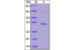 SARS-CoV-2 Envelope protein, GST,His Tag on SDS-PAGE under reducing (R) condition.
