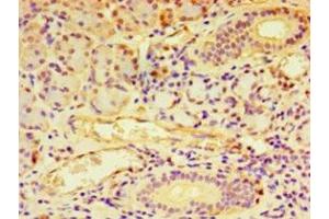 Immunohistochemistry of paraffin-embedded human pancreatic tissue using ABIN7145570 at dilution of 1:100 (NDST1 anticorps  (AA 40-556))