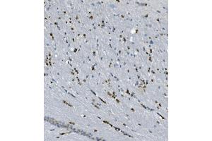 IHC analysis of Transketolase/TKT using anti-Transketolase/TKT antibody (ABIN7598959). (TKT anticorps  (AA 1-116))