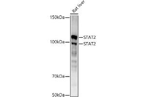 Western blot analysis of extracts of Rat liver, using ST antibody (ABIN1678782, ABIN3017845, ABIN3017846 and ABIN7101526) at 1:1000 dilution.