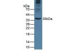 Detection of APOA5 in Mouse Liver Tissue using Monoclonal Antibody to Apolipoprotein A5 (APOA5) (APOA5 anticorps  (AA 21-210))