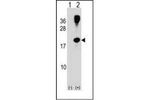 Western blot analysis of RHOG (arrow) using RhoG Antibody (C-term) Cat.