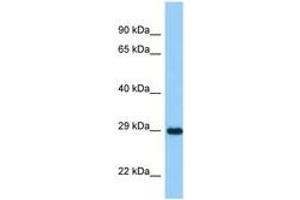 Image no. 1 for anti-Ankyrin Repeat and SOCS Box-Containing 11 (ASB11) (AA 21-70) antibody (ABIN6748270) (ASB11 anticorps  (AA 21-70))