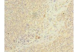 Immunohistochemistry of paraffin-embedded human tonsil tissue using ABIN7158460 at dilution of 1:100 (ARMC9 anticorps  (AA 401-665))