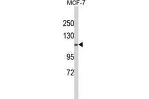 Western Blotting (WB) image for anti-Calponin Homology Domain Containing 2 (CHDC2) antibody (ABIN3003994) (CXorf22 anticorps)
