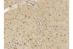 ABIN6265845 and ABIN6273337 at 1/100 staining human normal liver tissue by IHC-P. (UBE2E2 anticorps  (N-Term))