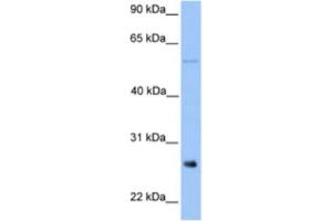 Western Blotting (WB) image for anti-Methyltransferase Like 7B (METTL7B) antibody (ABIN2463256) (METTL7B anticorps)