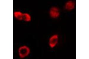 ABIN6274163 staining HeLa cells by IF/ICC. (HKR1 anticorps)