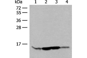 Western blot analysis of HL60 Hela 231 cell Human breast cancer tissue lysates using RPP14 Polyclonal Antibody at dilution of 1:400 (RPP14 anticorps)