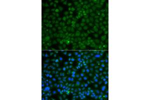 Immunofluorescence analysis of A549 cell using WDR45 antibody. (WDR45 anticorps)