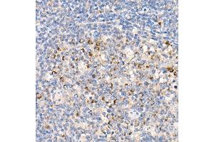 Immunohistochemistry of paraffin-embedded human tonsil using  Rabbit mAb (ABIN7265424) at dilution of 1:1000 (40x lens).