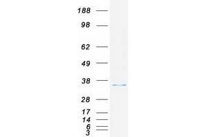 Validation with Western Blot