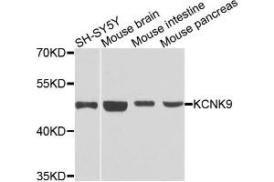 Western blot analysis of extracts of various cells, using KCNK9 antibody. (KCNK9 anticorps)