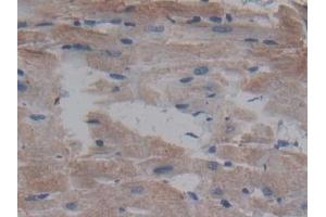 Detection of CDNF in Rat Heart Tissue using Polyclonal Antibody to Cerebral Dopamine Neurotrophic Factor (CDNF)