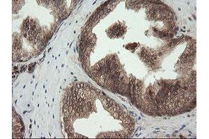 Image no. 8 for anti-Ubiquitin-Conjugating Enzyme E2G 2 (UBE2G2) antibody (ABIN1501634)