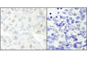 anti-SNW Domain Containing 1 (SNW1) (C-Term) antibody