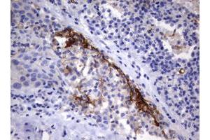 Image no. 3 for anti-Tumor Necrosis Factor Receptor Superfamily, Member 8 (TNFRSF8) (AA 19-379) antibody (ABIN1491085)