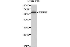 Western Blotting (WB) image for anti-Bone Morphogenetic Protein Receptor, Type IB (BMPR1B) (AA 1-126) antibody (ABIN3022720) (BMPR1B anticorps  (AA 1-126))