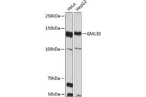 Western blot analysis of extracts of various cell lines, using GM130 Rabbit mAb (ABIN7267494) at 1:1000 dilution.