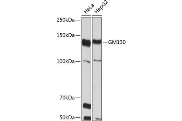 Golgin A2 (GOLGA2) anticorps