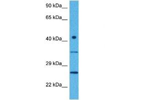 Host:  Rabbit  Target Name:  CTDNEP1  Sample Tissue:  Human MCF7 Whole Cell  Antibody Dilution:  1ug/ml (CTDNEP1A anticorps  (Middle Region))