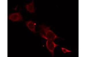 ABIN6274733 staining HT29 by IF/ICC.