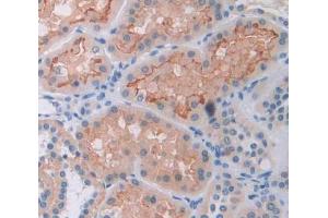 Used in DAB staining on fromalin fixed paraffin- embedded Kidney tissue (ADCY8 anticorps  (AA 234-371))
