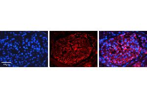 Rabbit Anti-PTCH1 Antibody   Formalin Fixed Paraffin Embedded Tissue: Human Testis Tissue Observed Staining: Plasma membrane Primary Antibody Concentration: 1:600 Other Working Concentrations: N/A Secondary Antibody: Donkey anti-Rabbit-Cy3 Secondary Antibody Concentration: 1:200 Magnification: 20X Exposure Time: 0.