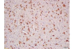 Formalin-fixed and paraffin embedded rat brain labeled with Rabbit Anti-HER4/ErbB4 Polyclonal Antibody, Unconjugated  at 1:200 followed by conjugation to the secondary antibody and DAB staining (ERBB4 anticorps  (AA 451-550))