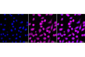 Immunocytochemical staining of HepG2 cells with Nibrin antibody (ABIN7799592), 1:1,000).