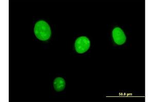 Immunofluorescence of monoclonal antibody to STK33 on HeLa cell.