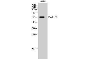Western Blotting (WB) image for anti-Forkhead Box C1 (FOXC1) (Internal Region) antibody (ABIN3184652) (FOXC1 anticorps  (Internal Region))