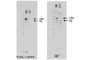 Western blot using  affinity purified anti-ABCB6 antibody (right panel, lane B6) shows detection of Flag tagged human ABCB6 protein at 104 kDa and a truncated form of the protein at 79 kDa (arrowheads). (ABCB6 anticorps  (AA 440-455))