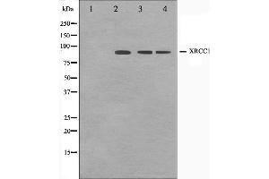 Western blot analysis on Jurkat,COS7 and HuvEc cell lysate using XRCC1 Antibody.