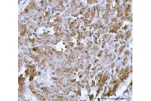 IHC analysis of DTR/HBEGF using anti-DTR/HBEGF antibody (ABIN7603042).