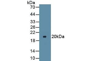 Detection of Recombinant IkBa, Mouse using Polyclonal Antibody to Inhibitory Subunit Of NF Kappa B Alpha (IkBa) (Inhibitory Subunit Of NF kappa B alpha anticorps)