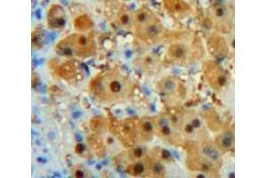 Used in DAB staining on fromalin fixed paraffin-embedded Liver tissue