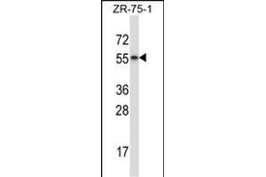 RORB Antibody (C-term) (ABIN657975 and ABIN2846921) western blot analysis in ZR-75-1 cell line lysates (35 μg/lane). (RORB anticorps  (C-Term))