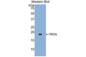 Western Blotting (WB) image for anti-Heparin-Binding EGF-Like Growth Factor (HBEGF) (AA 21-160) antibody (ABIN3206587) (HBEGF anticorps  (AA 21-160))