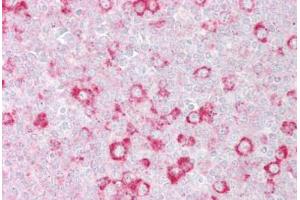 Anti-RHOD antibody IHC staining of human tonsil.